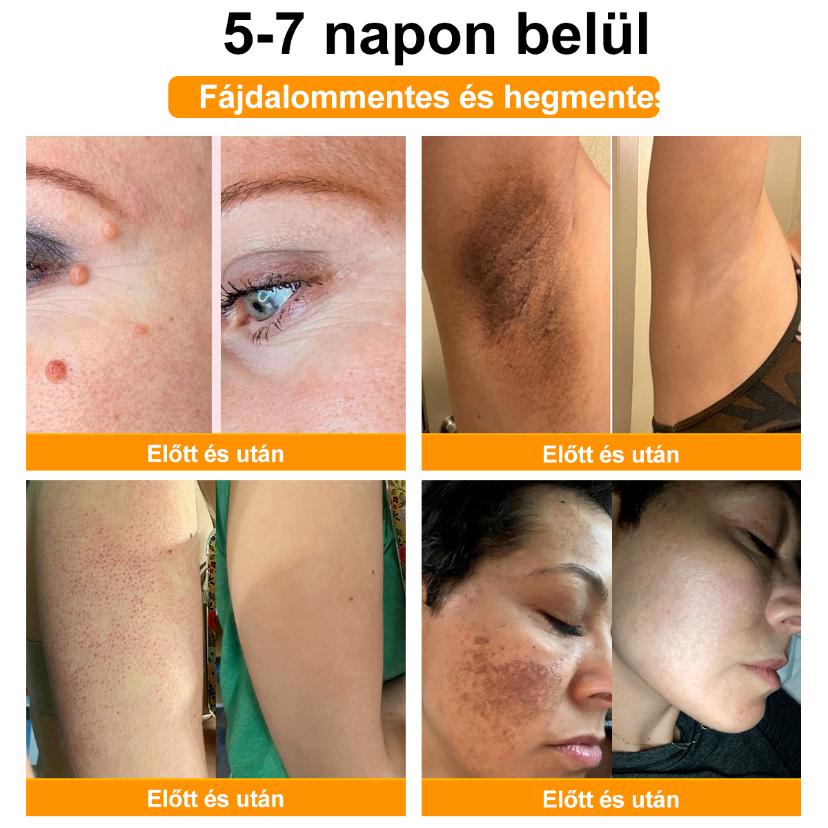 đđBSWELLÂź MĂ©hmĂ©reg KezelĂ©s KrĂ©mđšââïžïŒAAD ajĂĄnlottïŒ (đ„utolsĂł nap promĂłciĂł 80% ki