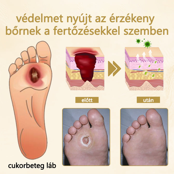 Cvreoz® méhméreg gyógyító spray a sebek gyógyulására és regenerálására a kezeken és a lábakon⭐️