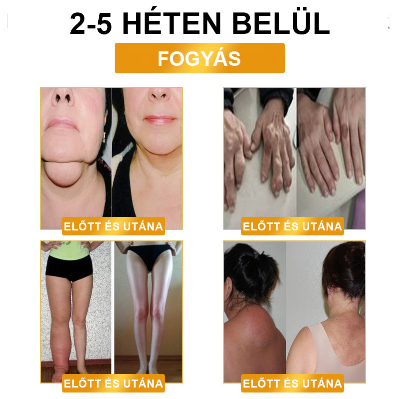 JOSFIT ultrahangos zsírfúvás és távoli infravörös vércukorszint-kiegyenlítő méregtelenítő csuklópánt - Energy Balance 🔥 Korlátozott idejű akció 🔥