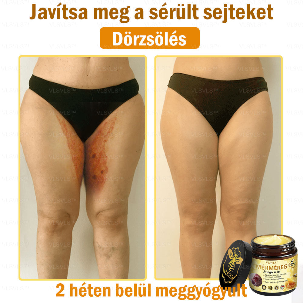 👑VLSVLS® Méhméreg Átfogó Krém (Minden korosztály számára alkalmas & HSME ajánlja)