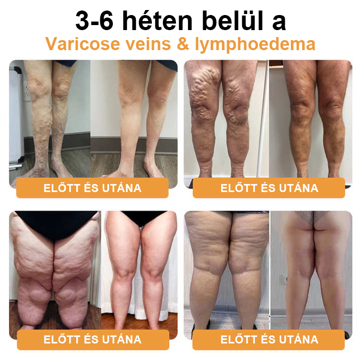 JOSFIT ultrahangos zsírfúvás és távoli infravörös vércukorszint-kiegyenlítő méregtelenítő csuklópánt - Energy Balance 🔥 Korlátozott idejű akció 🔥