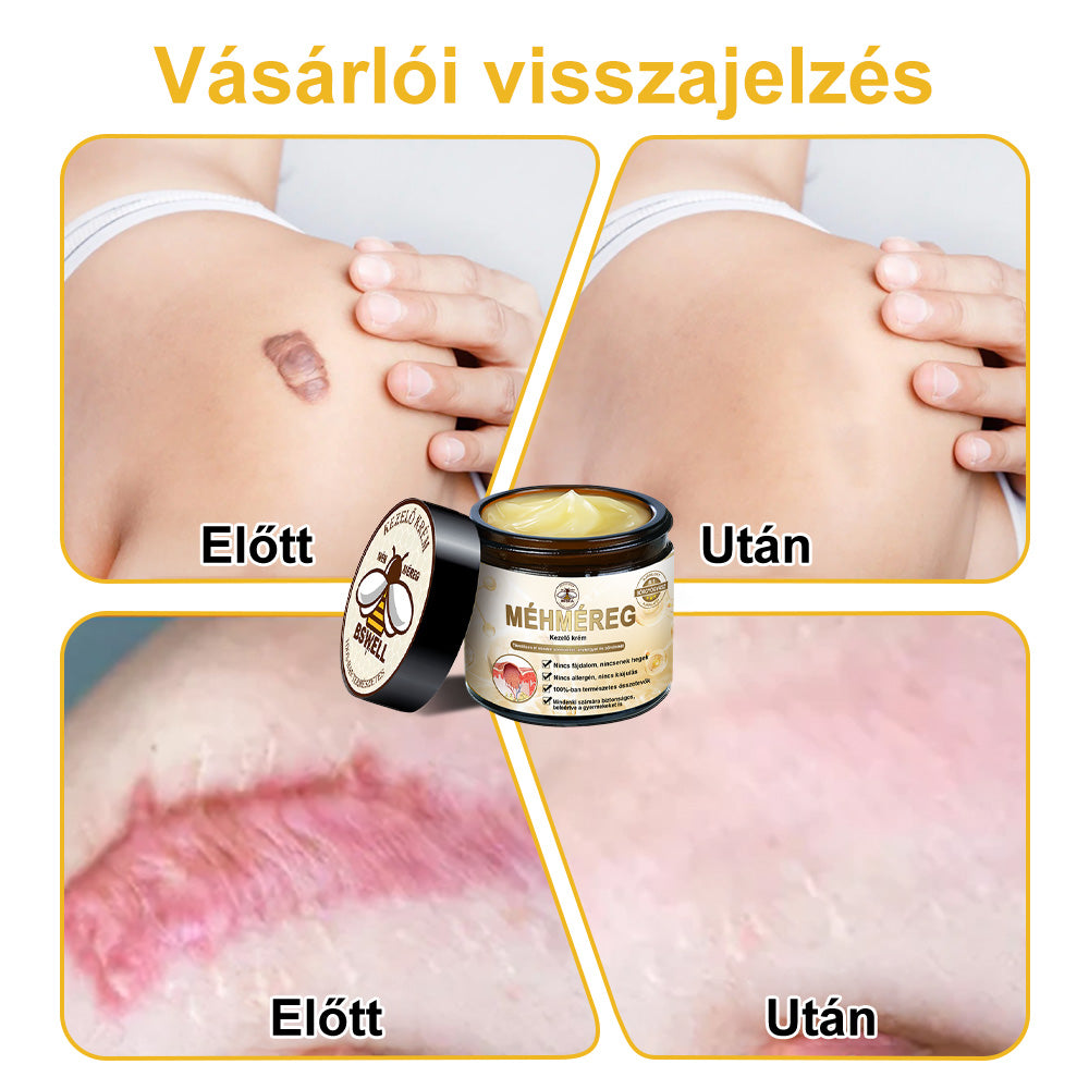 đđBSWELLÂź MĂ©hmĂ©reg KezelĂ©s KrĂ©mđšââïžïŒAAD ajĂĄnlottïŒ (đ„utolsĂł nap promĂłciĂł 80% ki