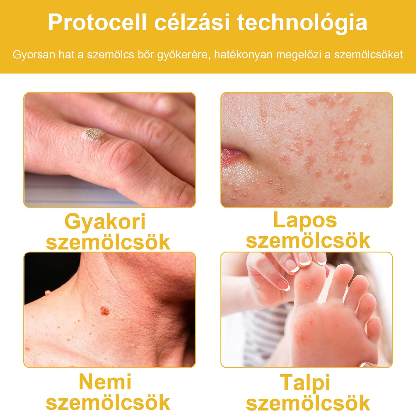 đđBSWELLÂź MĂ©hmĂ©reg KezelĂ©s KrĂ©mđšââïžïŒAAD ajĂĄnlottïŒ (đ„utolsĂł nap promĂłciĂł 80% ki