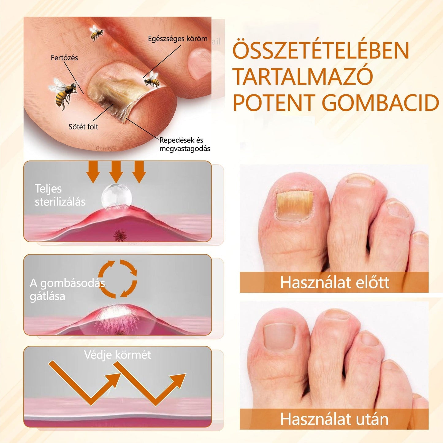 🎁Croaie® Fungiclear Méhterápiás Körömspray🎁