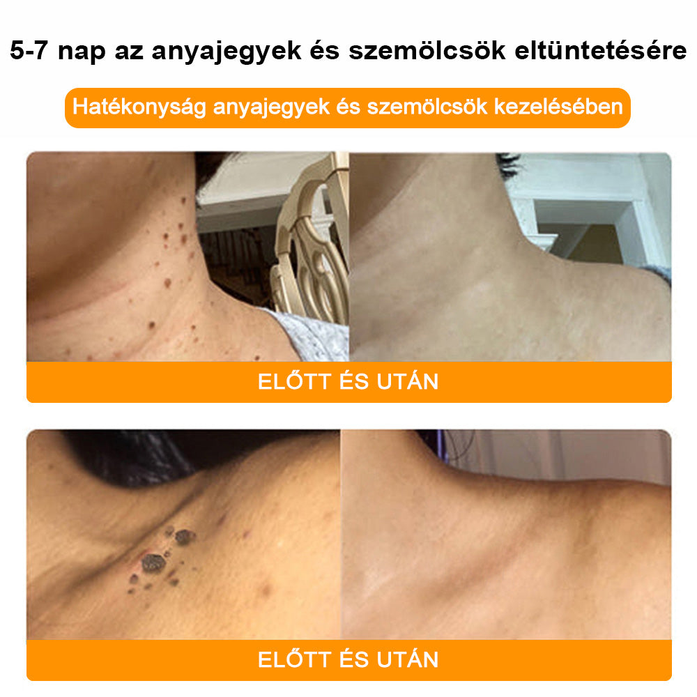 đđBSWELLÂź MĂ©hmĂ©reg KezelĂ©s KrĂ©mđšââïžïŒAAD ajĂĄnlottïŒ (đ„utolsĂł nap promĂłciĂł 80% ki
