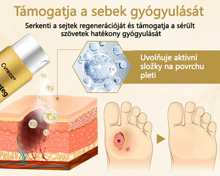 Cvreoz® méhméreg gyógyító spray a sebek gyógyulására és regenerálására a kezeken és a lábakon⭐️
