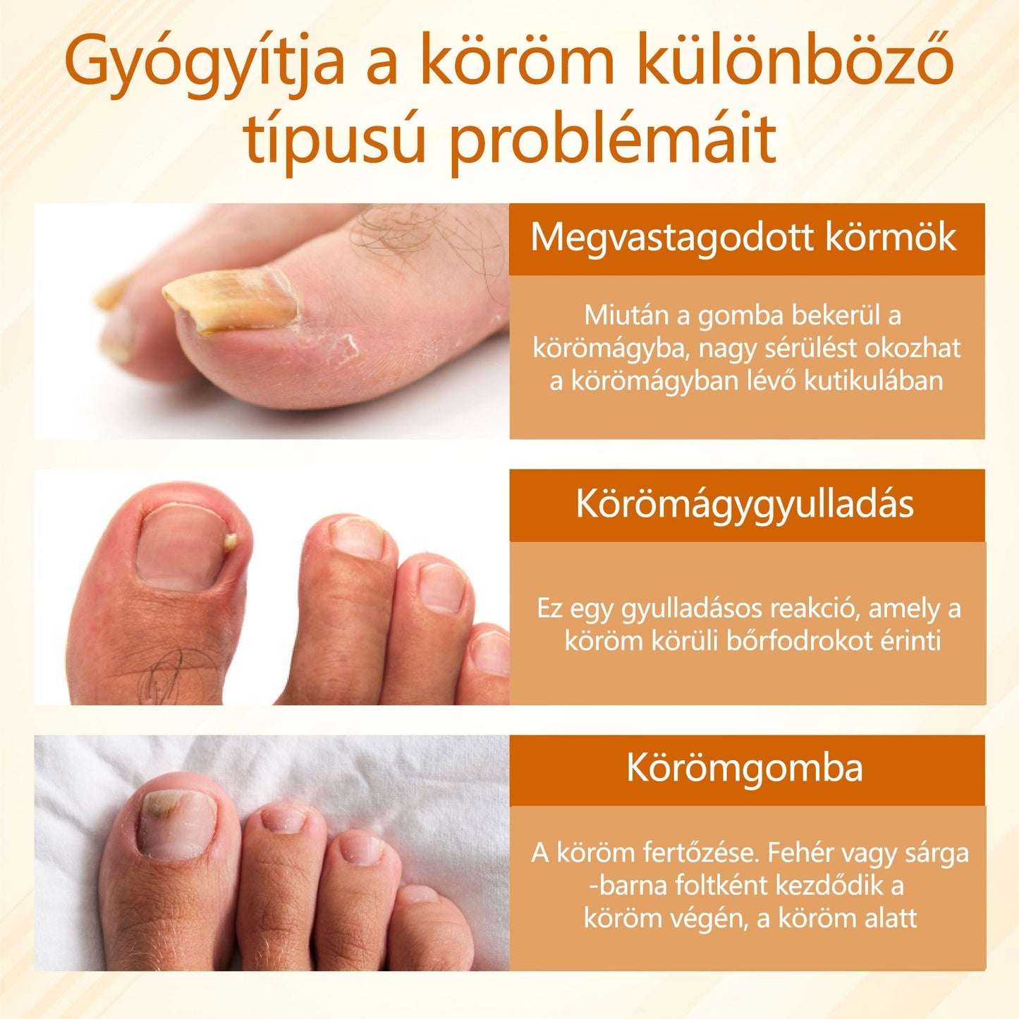 🎁Croaie® Fungiclear Méhterápiás Körömspray🎁