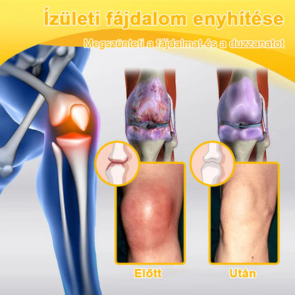 ArthroFree™ Méhméreg Fájdalomcsillapító Csontgyógyító Krém 🐝🌿🌿 (Kifejezetten idősek számára & az AIPM ajánlja)🔥🔥