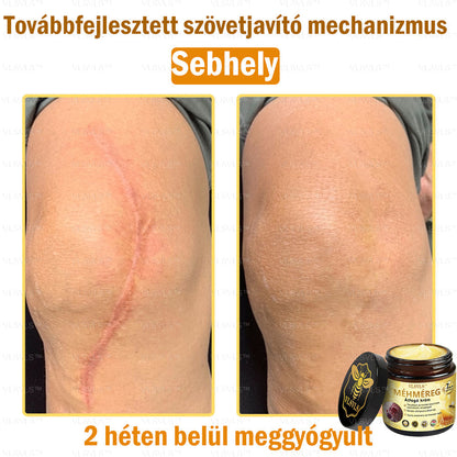 👑VLSVLS® Méhméreg Átfogó Krém (Minden korosztály számára alkalmas & HSME ajánlja)