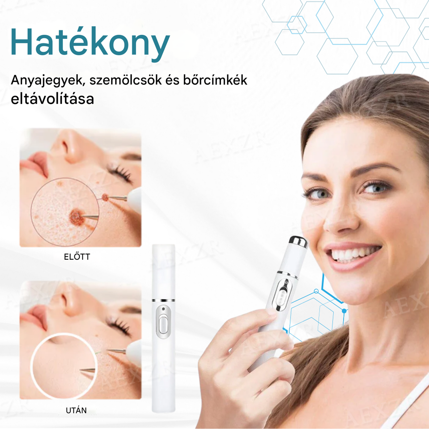 ✨Bikenda® non-invazív anyajegy- és szemölcseltávolító lézertoll✨