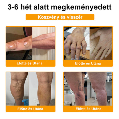 ArthroFree™ Méhméreg Fájdalomcsillapító Csontgyógyító Krém 🐝🌿🌿 (Kifejezetten idősek számára & az AIPM ajánlja)🔥🔥