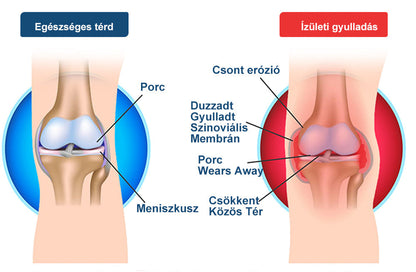 ArthroFree™ Méhméreg Fájdalomcsillapító Csontgyógyító Krém 🐝🌿🌿 (Kifejezetten idősek számára & az AIPM ajánlja)🔥🔥