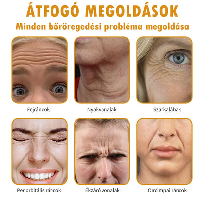 Az akció utolsó napja: 70% kedvezmény - ✨Furzero™ Botox Méhméreg Ránctalanító Krém