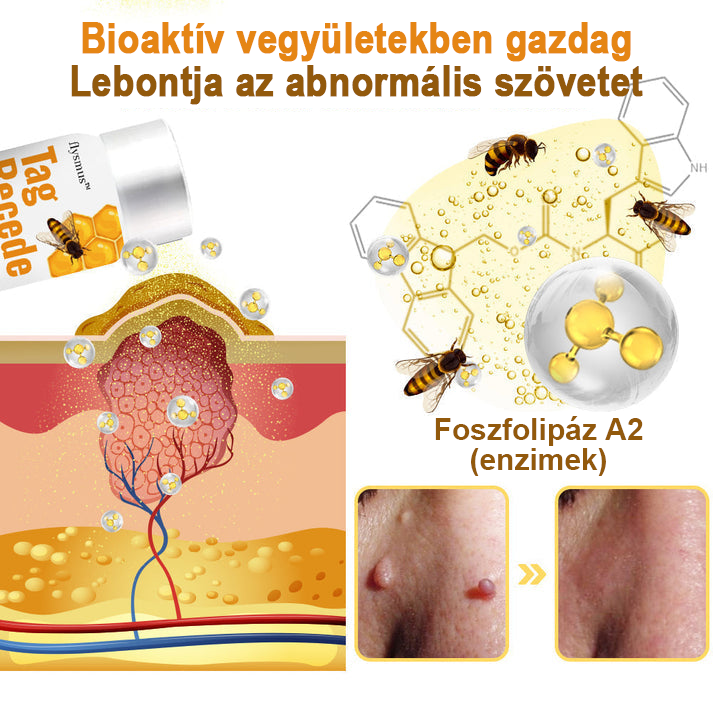 [💗utánvétel (COD)💗] Flysmus™Méhméreg szemölcs és övsömör eltávolító spray (👨‍⚕AAD Ajánlott) 🐝🐝🔥(🔥Last Day 80% Off)