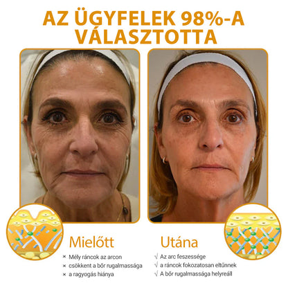 Az akció utolsó napja: 70% kedvezmény - ✨Furzero™ Botox Méhméreg Ránctalanító Krém