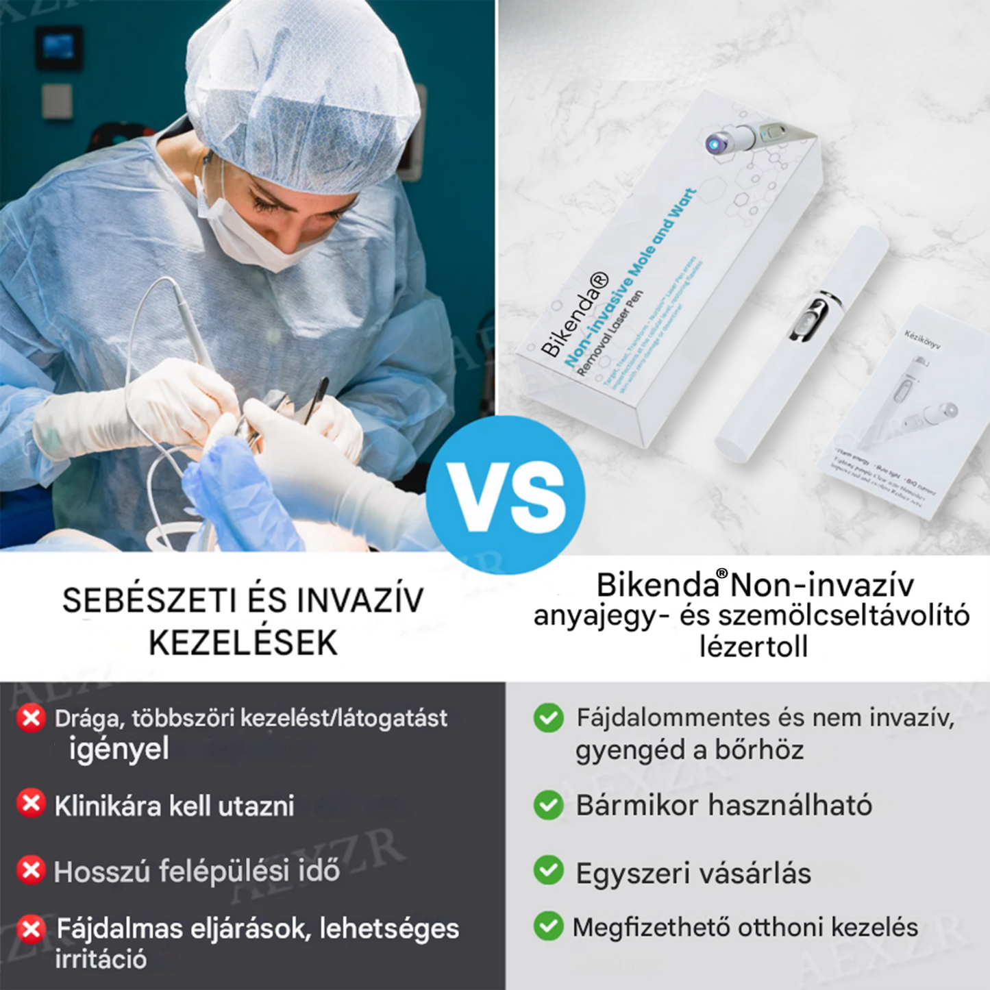 ✨Bikenda® non-invazív anyajegy- és szemölcseltávolító lézertoll✨