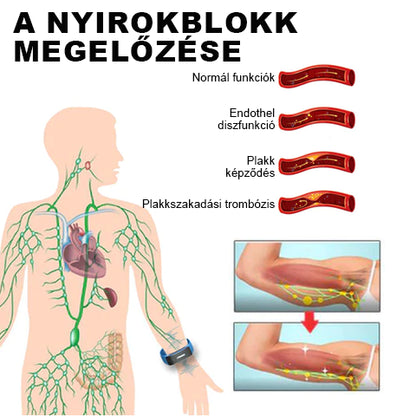 👨‍⚕️💉 𝐉𝐎𝐒𝐅𝑰𝐓™ Ultrahangos csuklópántok a zsír eltávolítására és méregtelenítésére.