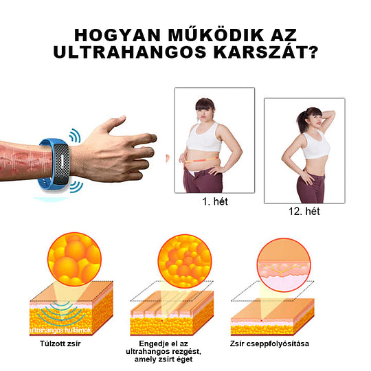 👨‍⚕️💉 𝐉𝐎𝐒𝐅𝑰𝐓™ Ultrahangos csuklópántok a zsír eltávolítására és méregtelenítésére.