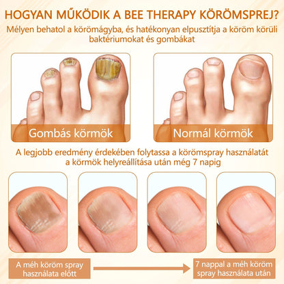 🎁Croaie® Fungiclear Méhterápiás Körömspray🎁