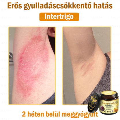 👑VLSVLS® Méhméreg Átfogó Krém (Minden korosztály számára alkalmas & HSME ajánlja)
