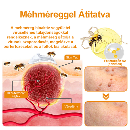 Vsoxa™ méhméreg szemölcs és anyajegy eltávolító krém (Utolsó napi akció, 80% kedvezmény)