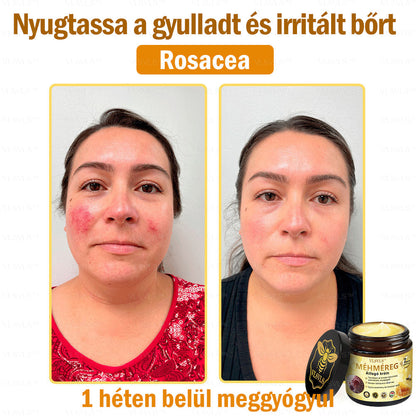 👑VLSVLS® Méhméreg Átfogó Krém (Minden korosztály számára alkalmas & HSME ajánlja)